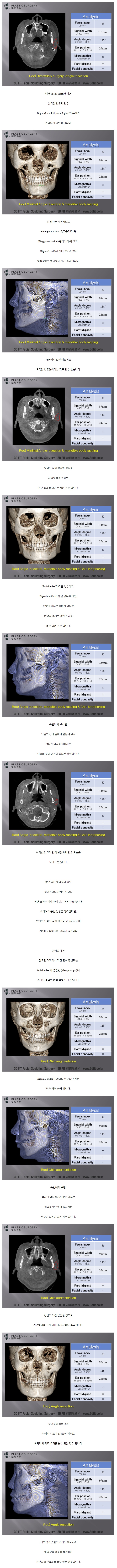 귀밑각.jpg