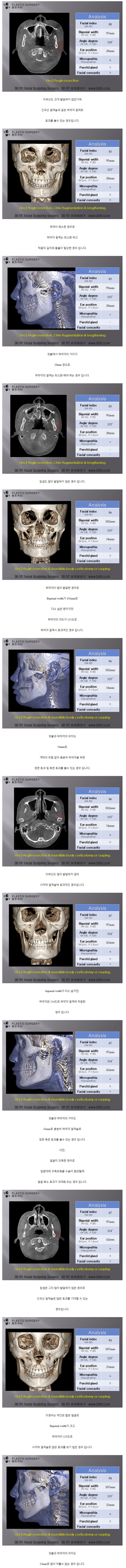 에이치성형외과.jpg