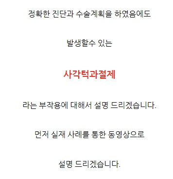 사각턱수술.jpg