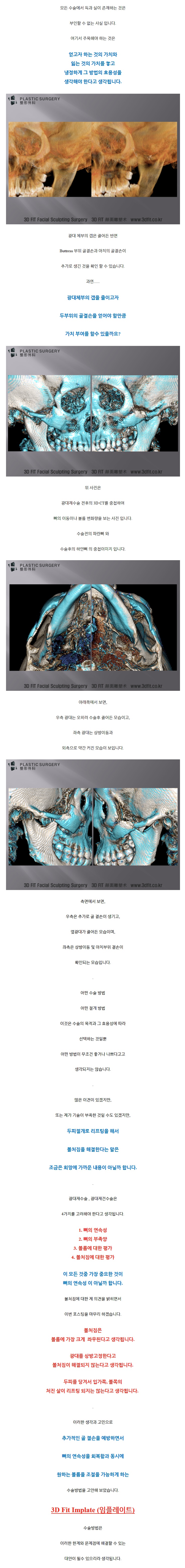 광대부작용.jpg