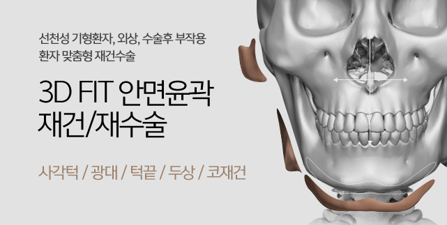 3D FIT 안면윤곽 재건/재수술